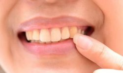 Ученые признали желтые зубы показателем здоровья